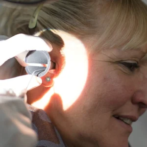 Professional Earwax Extraction (Per Ear)